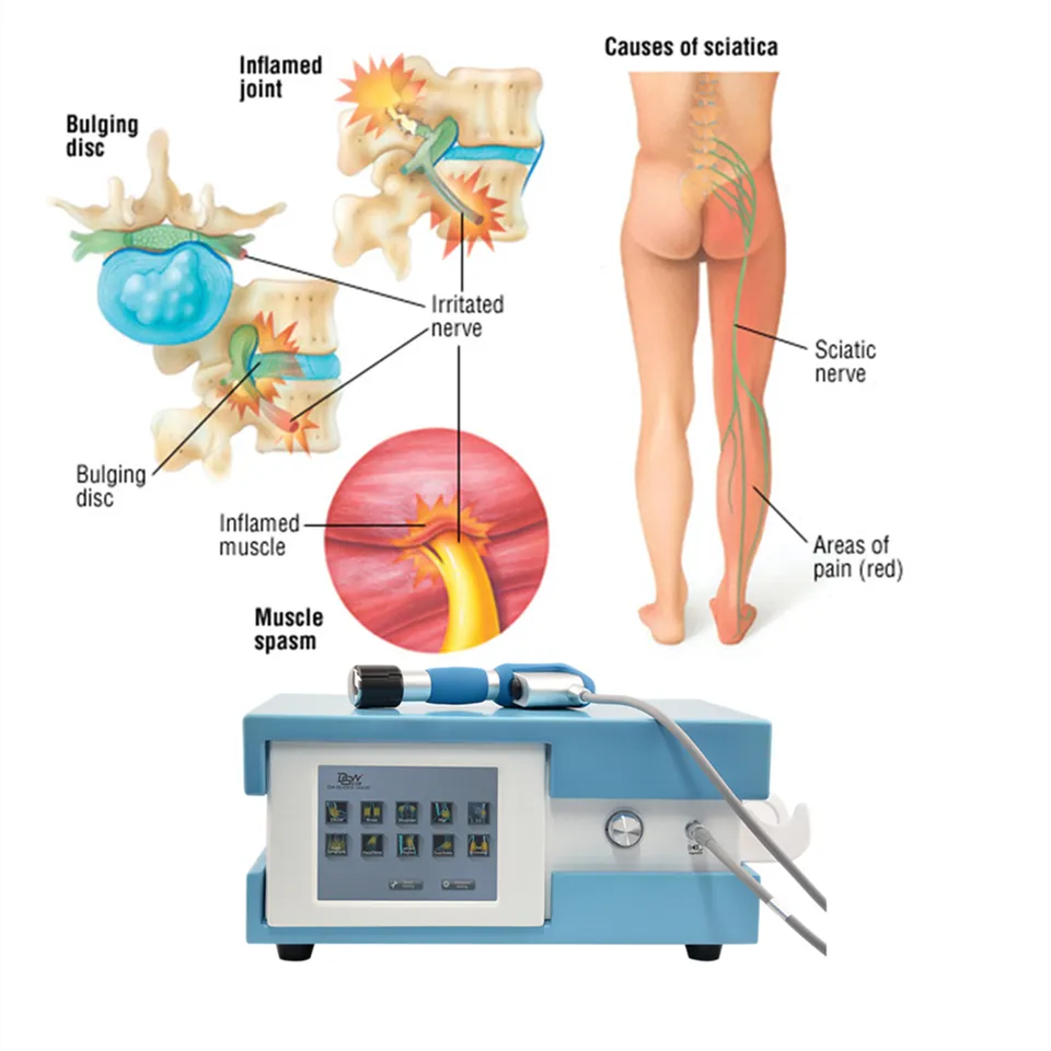 Electromagnetic Shockwave Physiotherapy Device for Erectile Dysfunction Eswt